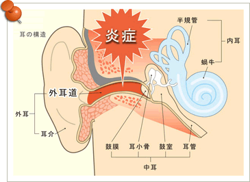 耳 舐め 中耳炎